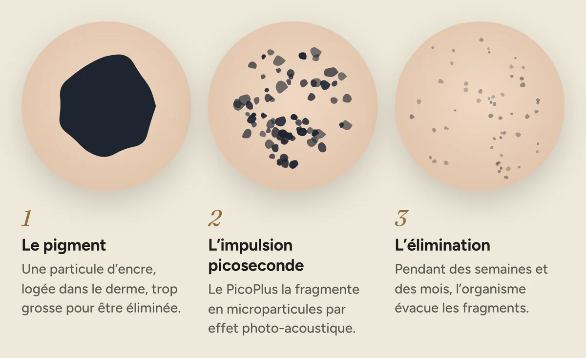 Schéma en trois étapes : pigment intact, fragmenté, puis éliminé